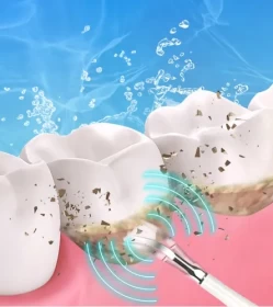 6 in 1 Electric Teeth Cleaner – Ultrasonic Dental Scaler, Teeth Whitening, Oral Care, USB Rechargeable